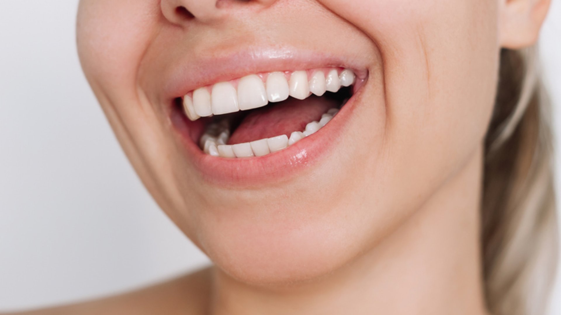 fehér és egészséges fogak mosoly tippek fogfehérítés